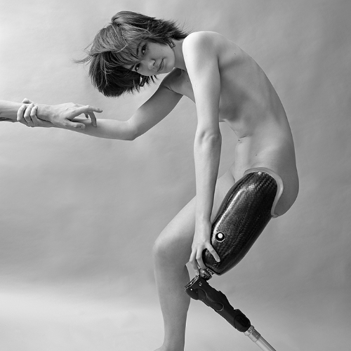 Life On A Prosthesis. - Photography Winner